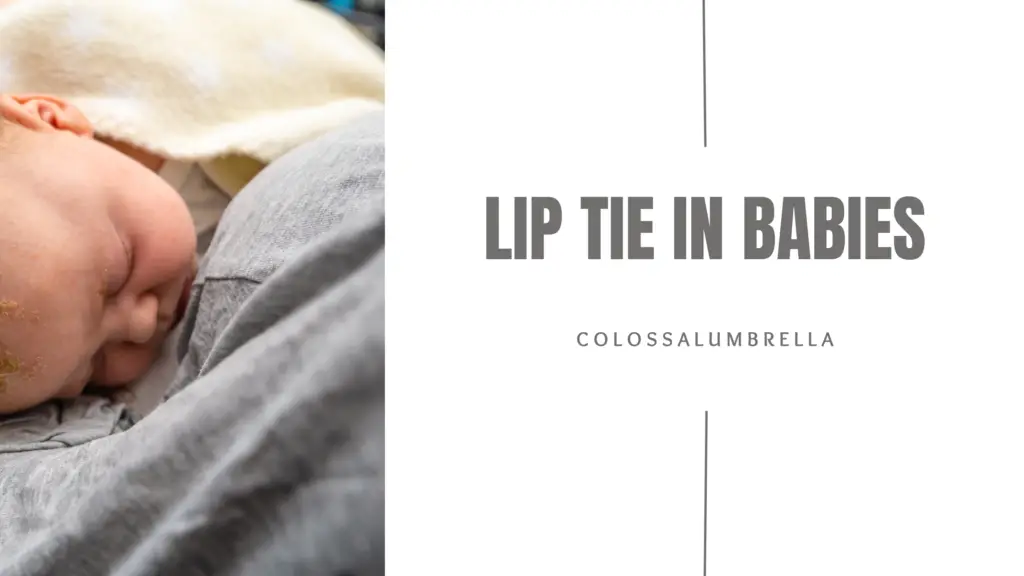 babies-lip-tie-problems-later-in-life-causes-symptoms-and-treatment